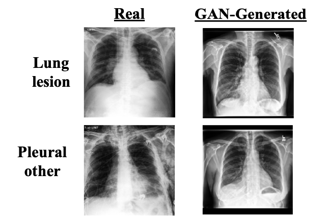 chest xray